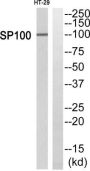 SP100 Nuclear Antigen (SP100) Antibody