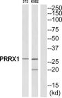 Paired Mesoderm Homeobox Protein 1 (PRRX1) Antibody