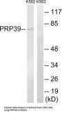 Pre-mRNA Processing Factor 39 (PRPF39) Antibody