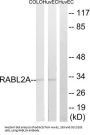 RAB, Member of RAS Oncogene Family Like 2A (RABL2A) Antibody