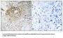 Sodium Channel Protein Type 9 Subunit Alpha (SCN9A) Antibody