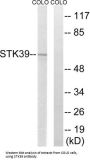 Serine/Threonine Kinase 39 (STK39) Antibody
