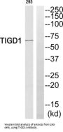 Tigger Transposable Element-Derived Protein 1 (TIGD1) Antibody