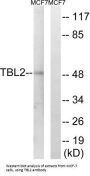 Transducin Beta Like 2 (TBL2) Antibody