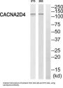 Calcium Voltage-Gated Channel Auxiliary Subunit Alpha2delta 4 (CACNA2D4) Antibody