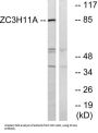 Zinc Finger CCCH Domain-Containing Protein 11A (ZC3H11A) Antibody