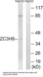 Zinc Finger CCCH Domain-Containing Protein 8 (ZC3H8) Antibody