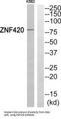 Zinc Finger Protein 420 (ZNF420) Antibody