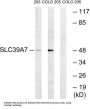 Solute Carrier Family 39, Member 7 (SLC39A7) Antibody