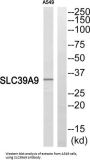 Solute Carrier Family 39 Member 9 (SLC39A9) Antibody
