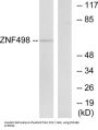 Zinc Finger Protein 498 (ZNF498) Antibody
