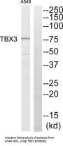 T-Box Protein 3 (TBX3) Antibody
