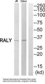 RALY Heterogeneous Nuclear Ribonucleoprotein (RALY) Antibody