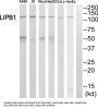 Liprin-Beta-1 (LIPB1) Antibody