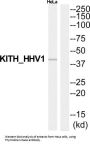 Thymidine Kinase (TK) Antibody