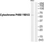 Cytochrome P450 11B1 / 2 Antibody