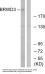 Heat Shock 70 kDa Protein 8 (HSPA8) Antibody
