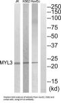 Myosin Light Chain 3 (MYL3) Antibody
