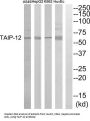 TGF-Beta-Induced Apoptosis Protein 12 (TAIP-12) Antibody
