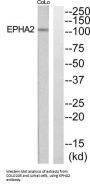EPH Receptor A2 (EPHA2) Antibody