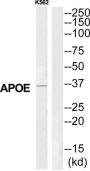 Apolipoprotein E (APOE) Antibody