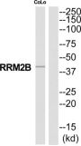 Ribonucleoside-Diphosphate Reductase Subunit M2 B (RRM2B) Antibody
