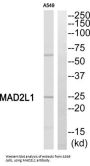 Mitotic Arrest Deficient 2 Like 1 (MAD2L1) Antibody