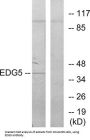 Sphingosine 1-Phosphate Receptor 2 (S1PR2) Antibody
