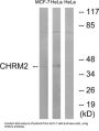 Muscarinic Acetylcholine Receptor M2 (CHRM2) Antibody