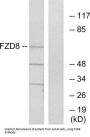 Frizzled Homolog 8 (FZD8) Antibody