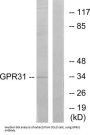 G Protein-Coupled Receptor 31 (GPR31) Antibody