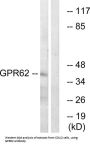 G Protein-Coupled Receptor 62 (GPR62) Antibody
