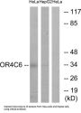 Olfactory Receptor Family 4 Subfamily C Member 6 (OR4C6) Antibody