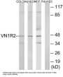 Vomeronasal 1 Receptor 2 (VN1R2) Antibody