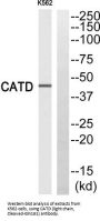 Cathepsin D Cleaved-Gln161 Light Chain (CTSD Cleaved-Gln161) Antibody