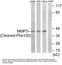 Matrix Metalloproteinase 3 Cleaved-Phe100 (MMP3 Cleaved-F100) Antibody
