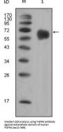 Fibroblast Growth Factor Receptor 4 (FGFR4) Antibody