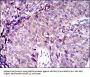 Multidrug Resistance-Associated Protein 4 (ABCC4) Antibody