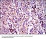 Multidrug Resistance-Associated Protein 4 (ABCC4) Antibody