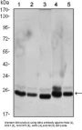 Chromobox Protein Homolog 1 (CBX1) Antibody