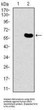 Dickkopf-Related Protein 3 (DKK3) Antibody