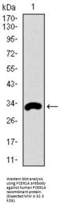 Fc Fragment of IgE, High Affinity I, Receptor (FCER1A) Antibody