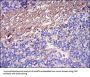 Fibrinogen Gamma (FGG) Antibody