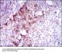 Receptor-Type Tyrosine-Protein Kinase FLT3 (FLT3) Antibody