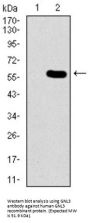 Guanine Nucleotide Binding Protein Like 3 (Nucleolar) (GNL3) Antibody