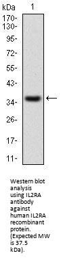 Interleukin 2 Receptor Alpha (IL2RA) Antibody