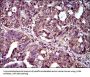 Interleukin 2 Receptor Alpha (IL2RA) Antibody