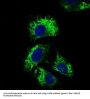 Interleukin 2 Receptor Alpha (IL2RA) Antibody