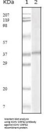 KSHV ORF62 Antibody