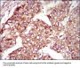 Microtubule-Associated Proteins 1A/1B Light Chain 3A (MAP1LC3A) Antibody